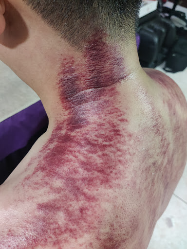 Resonance Sport Injury & Pain Relief Rehabilitation 立舒堂 專業運動理疗与復健 筋骨傷疼痛理疗工作室