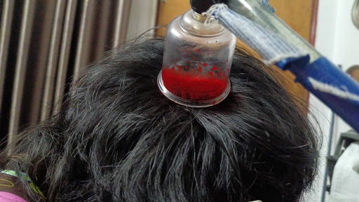Bekam Profesional Al-Muzafa Bekam Profesional Al-Muzafa