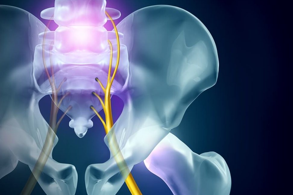 KF Natural Wellness Centre (Physiotherapy, Chiropractic, Rehab, Acupuncture, Stroke, Slip Disc, Sciatica) 1 kf natural wellness centre physiotherapy chiropractic rehab acupuncture stroke slip disc sciatica