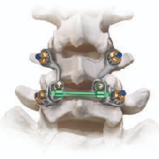 Spine&Joint Hartamas 1 spinejoint hartamas