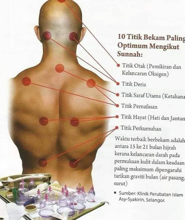 urut bekam buang angin medu lelaki